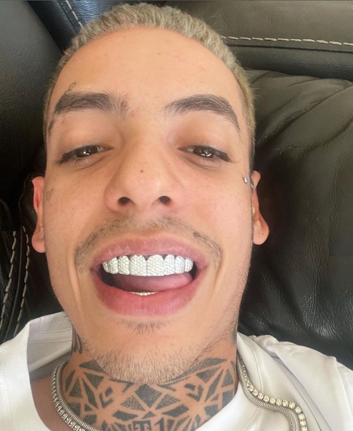 ¿Cuánto cuesta ponerse diamantes en los dientes como Natanael Cano?