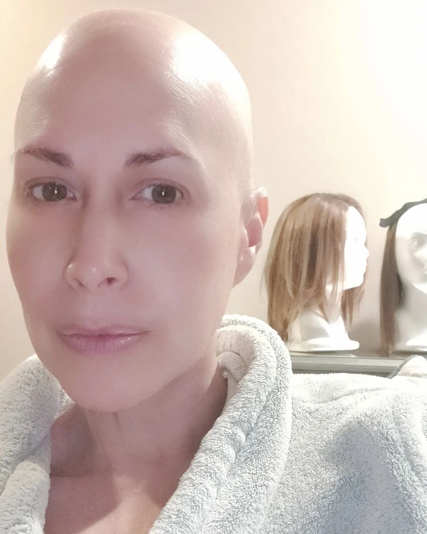 Martha Guzmán comparte foto sin cabello después de quimioterapia 