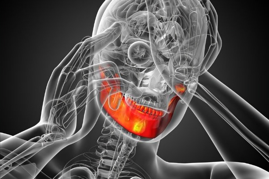 ¿qué es la dislocación mandibular problema de Nodal?
