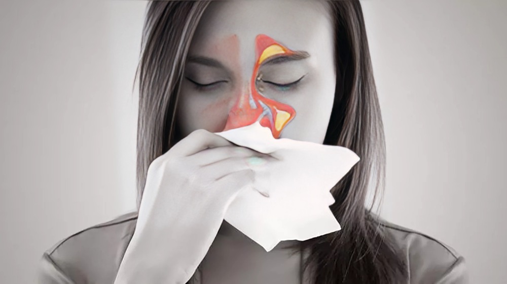 ¿qué es la sinusitis crónica?