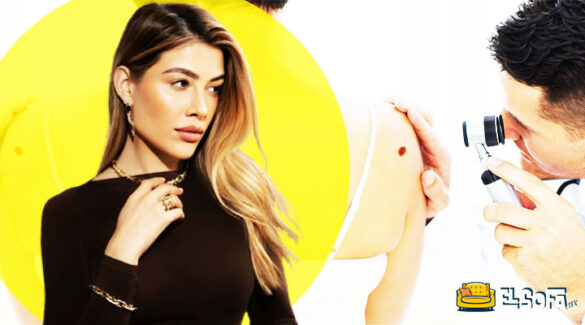 ¿Cuál es la dura enfermedad que afecta a Michelle Salas?