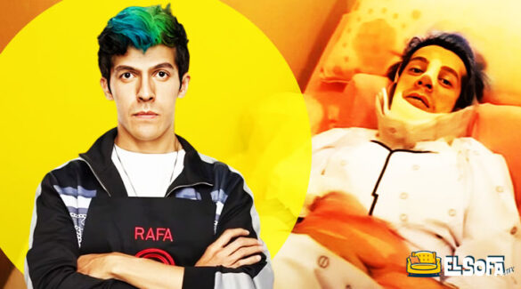 Rafa Polinesio. El antes y después de su cirugía de nariz